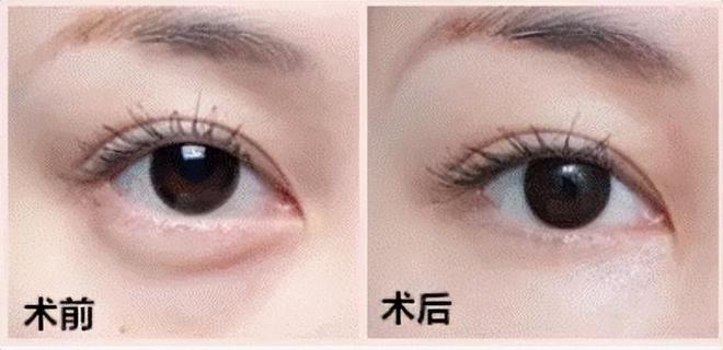 玻璃基覆铜板 第254页
